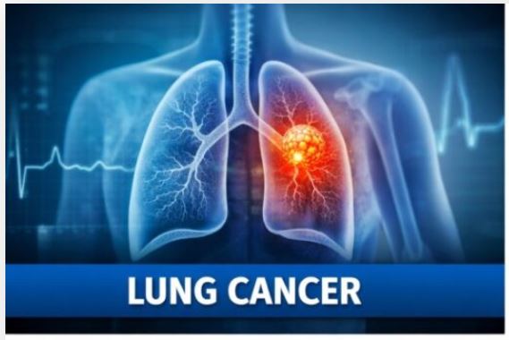 Cancer: Types, Symptoms, Causes, and Life-Saving Treatments