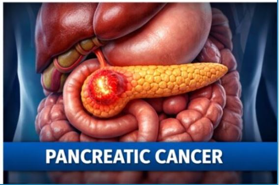 Cancer: Types, Symptoms, Causes, and Life-Saving Treatments